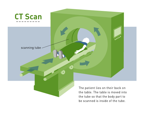 CT Scan